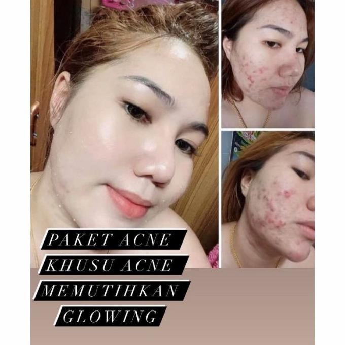 Paket Usaha Nr Glow Skincare Paket Pemutih Wajah