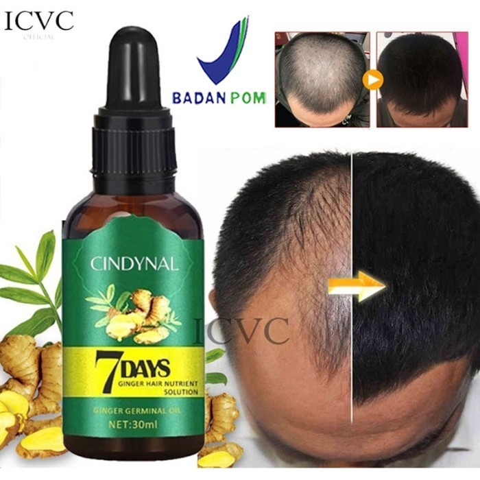 [BPOM] CINDYNAL 7 DAY GINGER SERUM 7 DAYS HAIR TONIC GINSENG RAMBUT