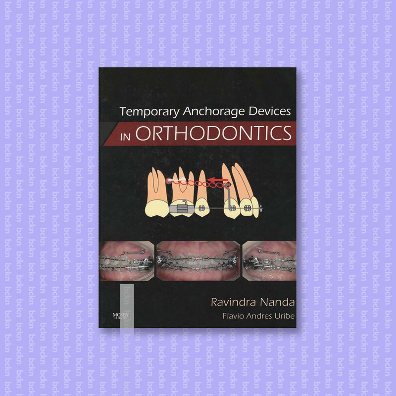 

Temporary Anchorage Devices in Orthodontic - Ravindra Nanda