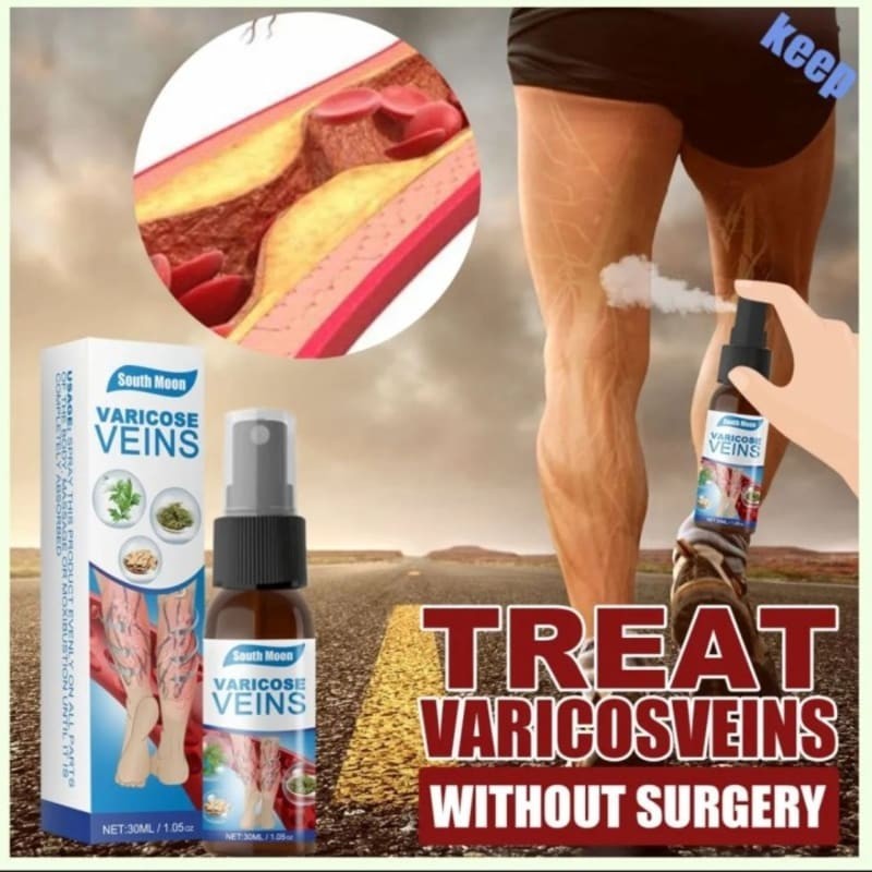 Varicose Veins Spray ( Semprotan  Varises ) Nyeri Varises Terlaris
