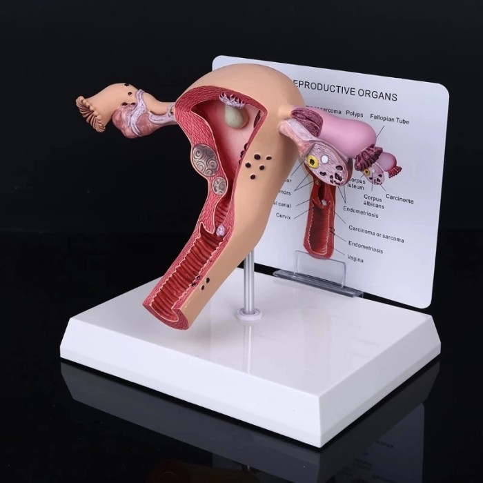 

Manekin Alat Peraga Model Anatomi Human Female Uterus Ovary Disease