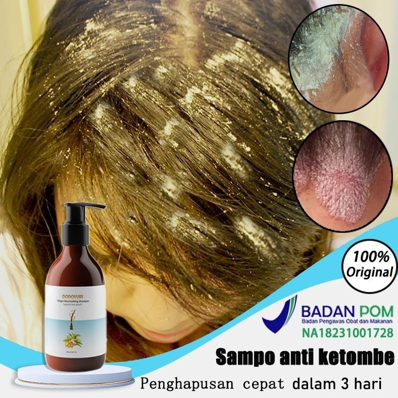 Sampo anti ketombe sampo anti ketombe dan rontok sampo penumbuh rambut cepat 300ml penumbuh rambut c