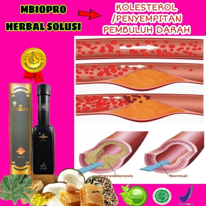 

MBIOPRO HERBAL SOLUSI KOLESTEROL DAN PENYEMPITAN PEMBULUH DARAH