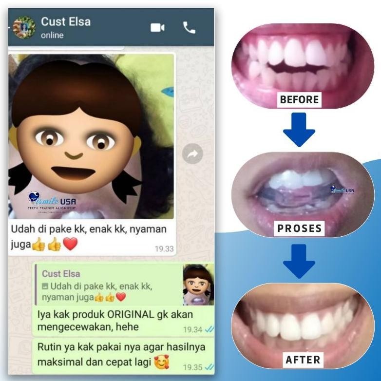 GH 100% Original Perapih Gigi USA || Perata Gigi Original ismileUSA || Teeth Trainer ismileUSA Origi