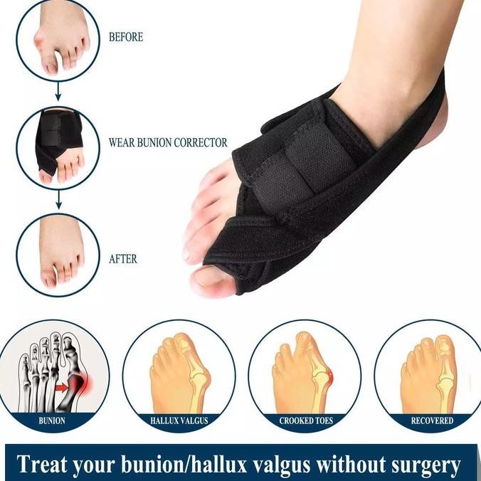 

Bunion Corrector Toe Separator Finger Splint Hallux Valgus Jempol Baru
