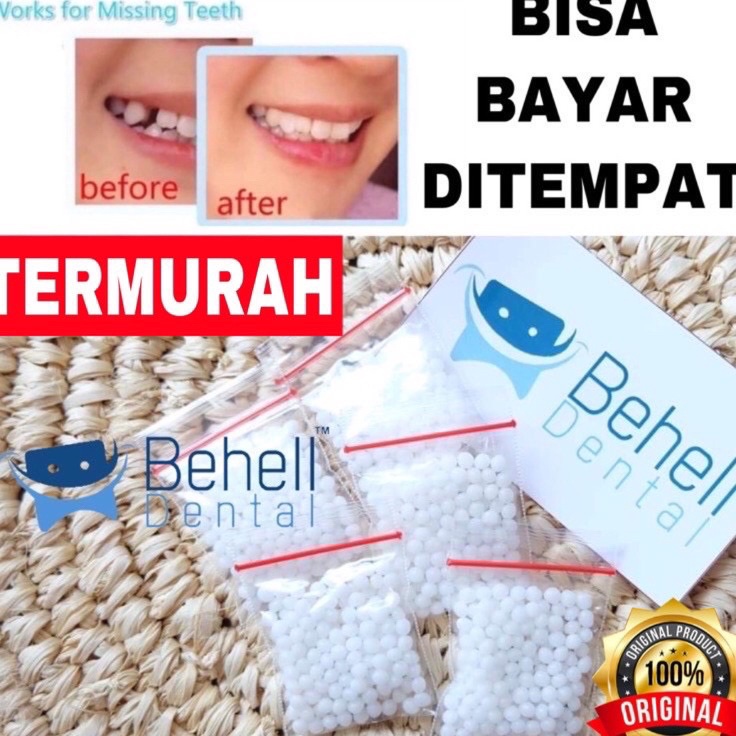 Terbaru GIGI PALSU SEMENTARA 200 BUTIR / PENAMBAL GIGI PATAH RENGGANG TEMPORARY TOOTH TEMPTOOTH GING
