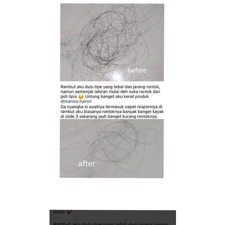 Rontok Botak Manise Hair Oil - Cek Testi Tonic Serum Nyak Rambut Keri Follow Me Shampoo Fall