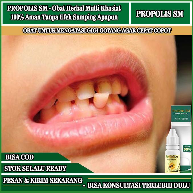 Obat Gigi Goyang,Pengencang Gigi Goyang,Obat Tetes/Kumur Gigi Goyang LDS