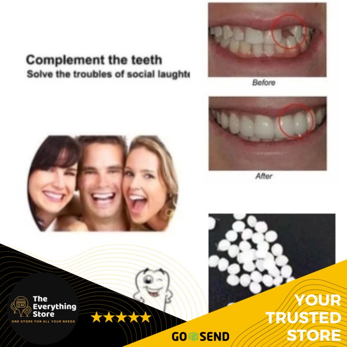 Fident Penambal Gigi