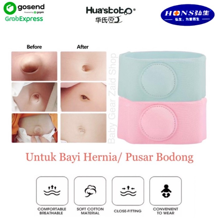 Baby Infantile Umbilical Hernia / Sabuk Hernia Bayi