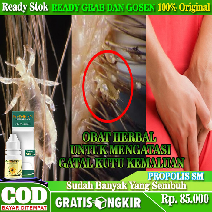 Terbaru Obat Pembasmi Kutu Rambut Kemaluan, Obat Oles Gatal Kutu Pubis Kelamin Promo Terlaris