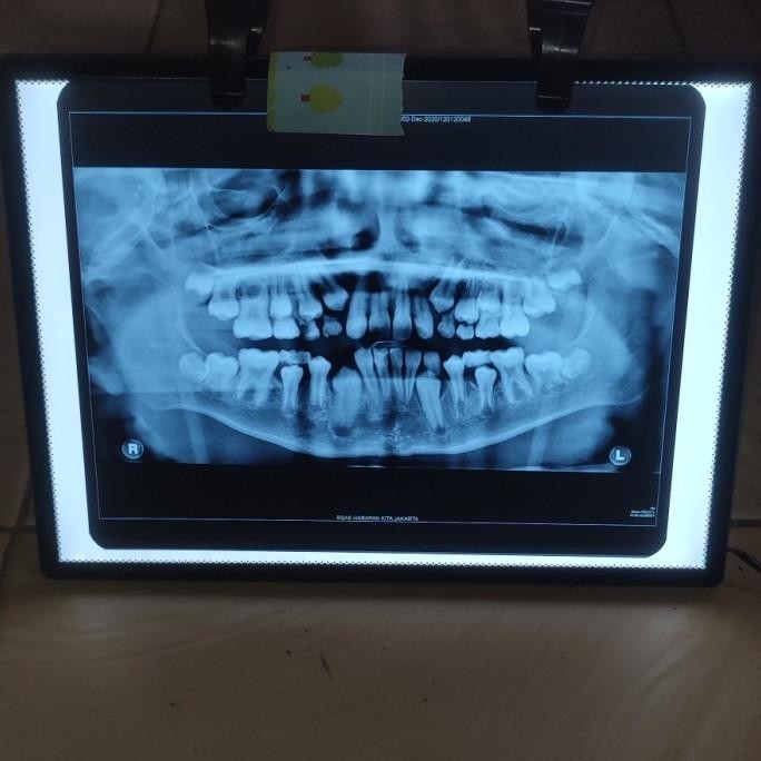 Dental viewer X ray LED rontgen A4 slim / lampu baca rontgen