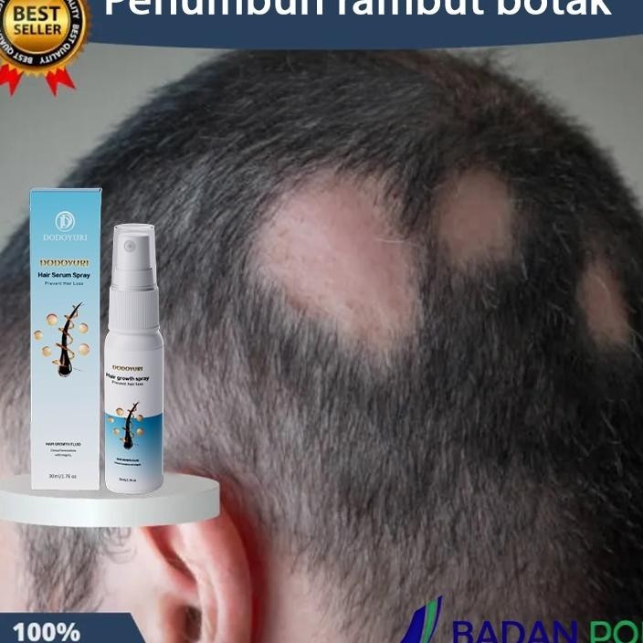 (Bpom)Obat Umbuh Rambut Umbuh Rambut Cepat Serum Umbuh Rambut Umbuh Rambut Botak 30Ml Kontrol Nyak S