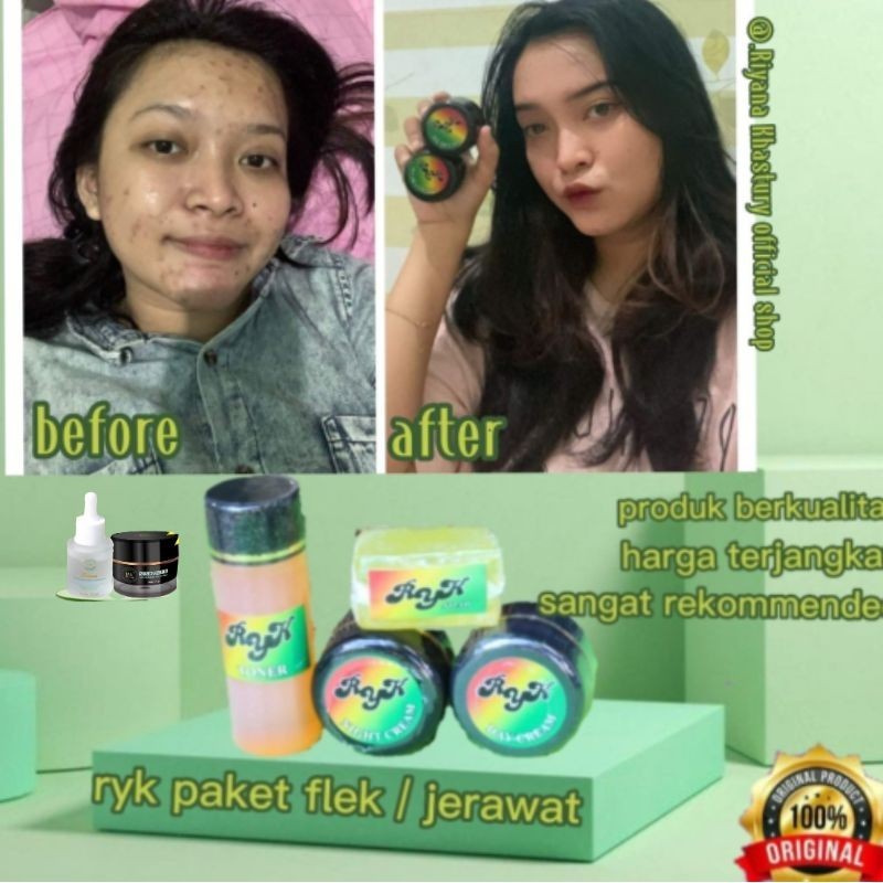 RYK SKINCARE paket plek hitam menahun tebal