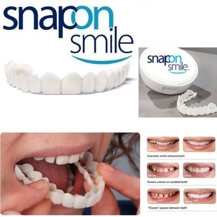 SNAP ON SMILE PAKET KARET GIGI PALSU 1 SET ATAS BAWAH ORIGINAL