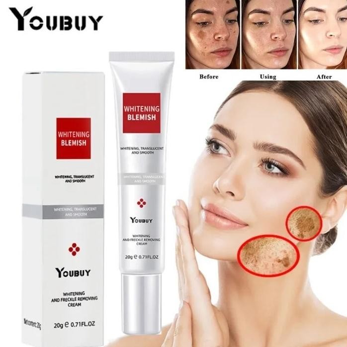 BPOMYOUBUY WHITENING FRECKLE CREAM REMOVE DARK SPOTS ANTI FRECKLE CREAM NIACINAMIDE FADE PIGMENTATIO
