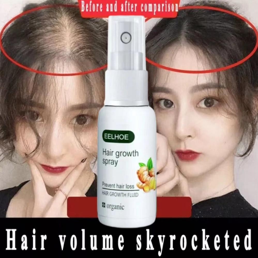 EELHOE HAIR GROWTH SPRAY PERTUMBUHAN RAMBUT UNTUK PRIA DAN WANITA SPRAY PENEBALAN RAMBUT GINGER GERM
