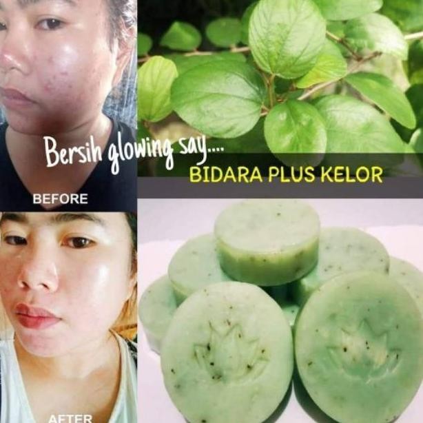 Terlaris Aleya Sabun Bidara Aleya Plus Kelor Bpom Original Original
