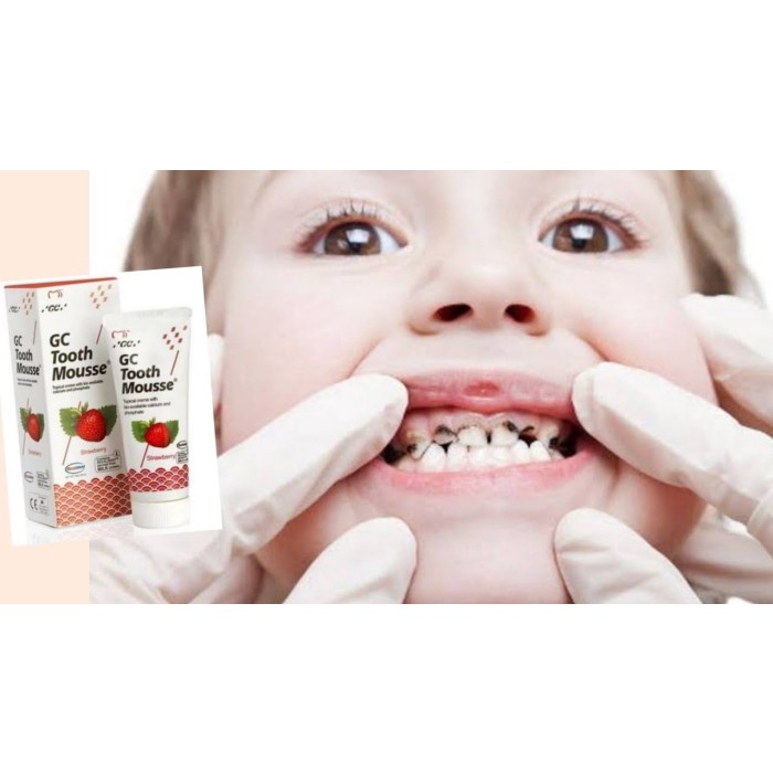 VItamin GC Tooth Mousse Regular untuk Anak dan Dewasa