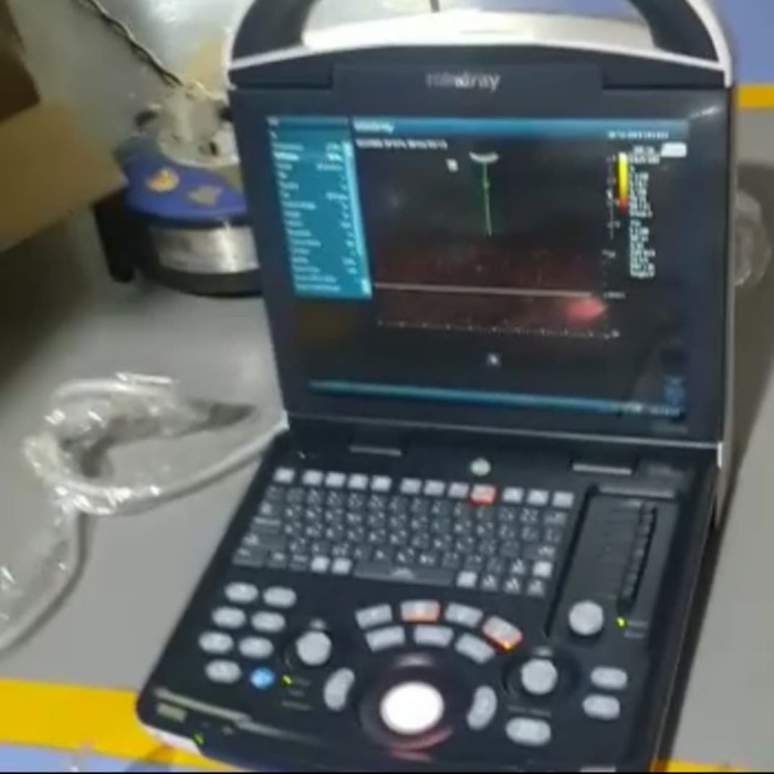 [New Ori] Usg 2 Dimensi Mindray Dp 10 Bisa Sameday