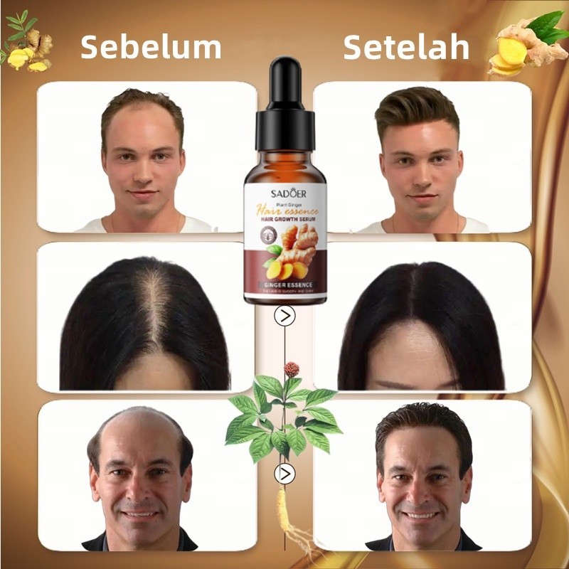 Umbuh Rambut Serum Umbuh Rambut Umbuh Rambut Botak Nyak Umbuh Rambut Hair Growth Serum Umbuh Rambut
