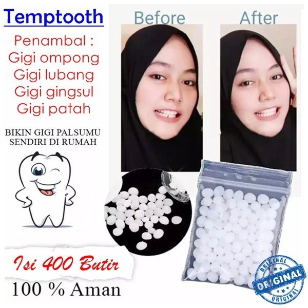 PENAMBAL GIGI BOLONG DAN OMPONG 400 BUTIR ORI TEMPTOOTH LEM GIGI PALSU