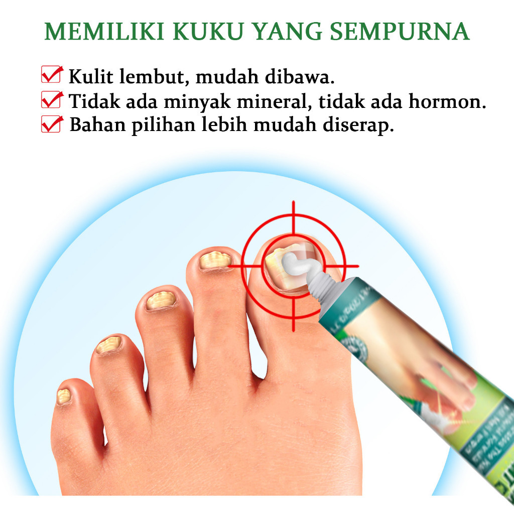 [READY] Obat Jamur Kuku obat kuku jamur dan rusak vitamin kuku rusak perawatan kuku 20g Obat