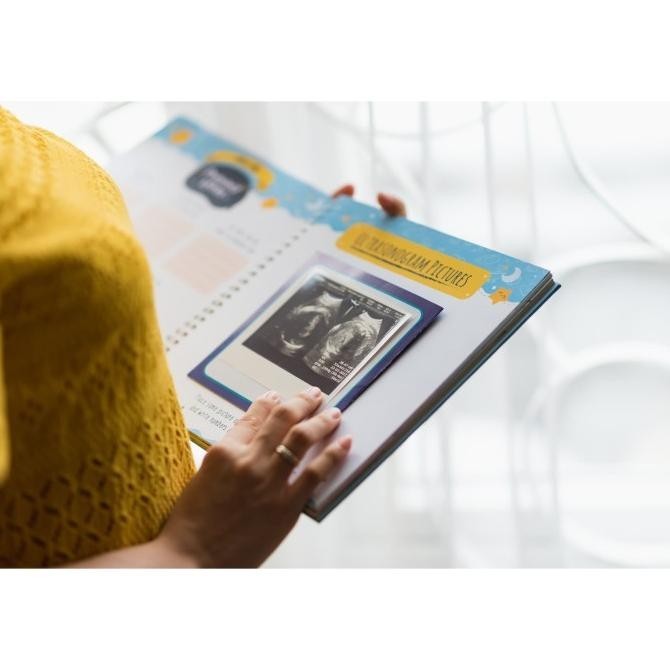 

Baby Journal / Buku Bayi / Baby Book My Little Treasure (Yellow)