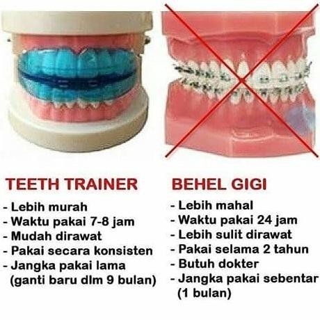 Behel Gigi Lepas Pasang Perapi Dental Teeth Trainer Behel Gigi