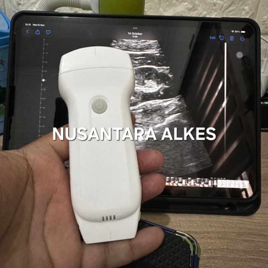 USG Wireless Konted C10RL