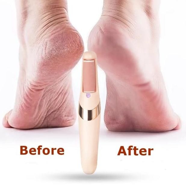 QWE AZ ALAT KIKIR KAKI / PENGHALUS KAKI ELEKTRIK PEDICURE TERLARIS