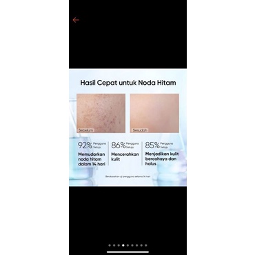 SERUM SKINTIFIC DRAKSPOT 377