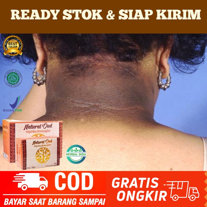 SABUN PEMUTIH LIPATAN LEHER, SABUN MEMUTIHKAN TENGKUK LEHER YANG HITAM