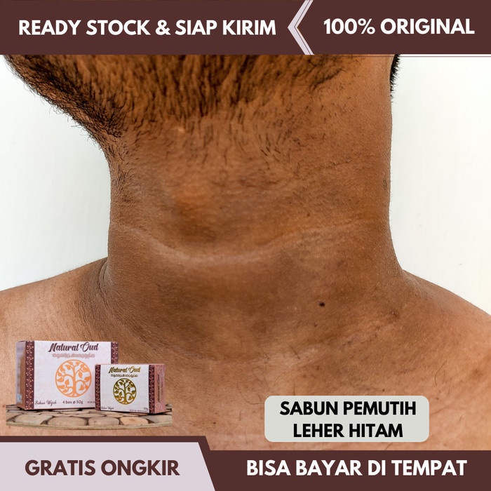 SABUN PEMUTIH LEHER HITAM, SABUN PEMBERSIH KULIT HITAM, BERKERAK