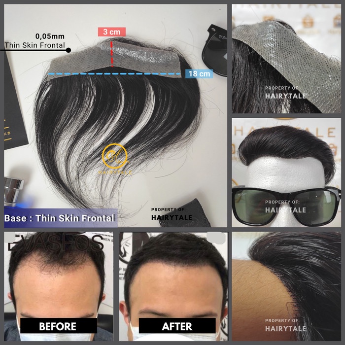 Toupee/Tutup Botak Dahi Pria, Thin Skin (Pu) 3X18Cm, 100% Hair