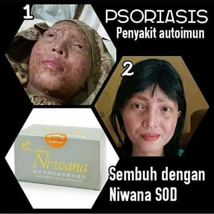 Paket Hemat Niwana Sod 3 Box Kk Indonesia Ori 100%