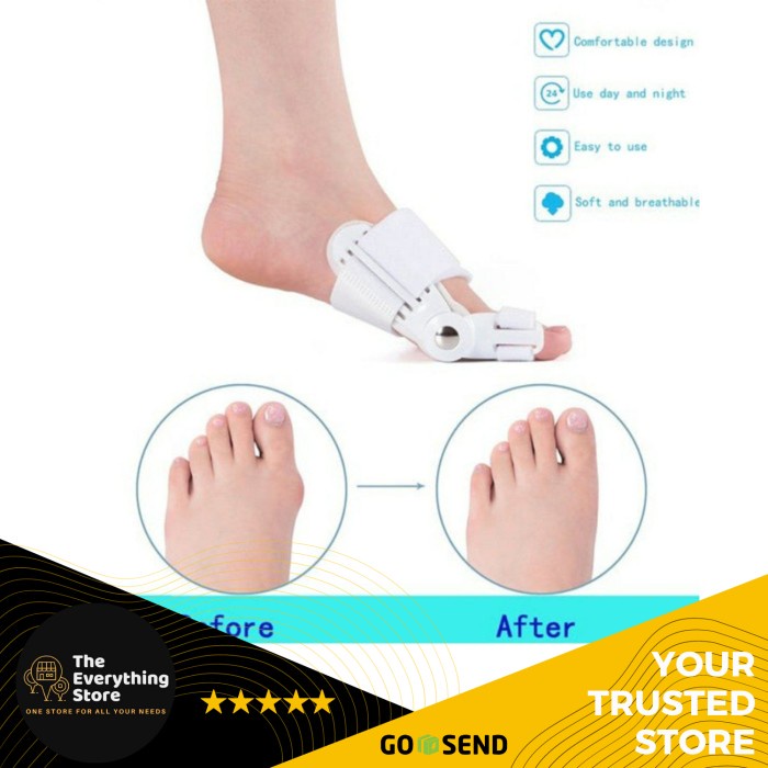 Uzzu Alat Korektor Jempol Uzzu Alat Krektor Jempol Kaki Bunion Tes