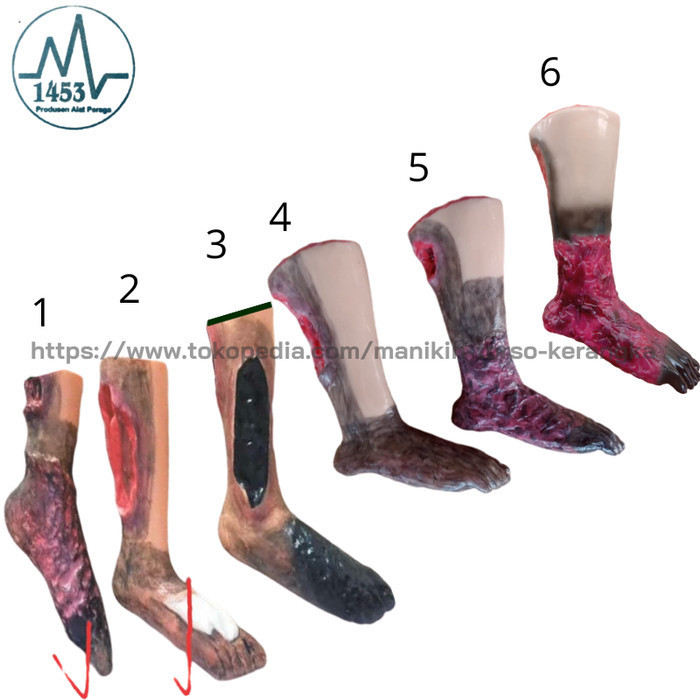 [PRODUSEN] KAKI LUKA DEKUBITUS/ALAT PERAGA/PHANTOM/MANIKIN/SILICONE
