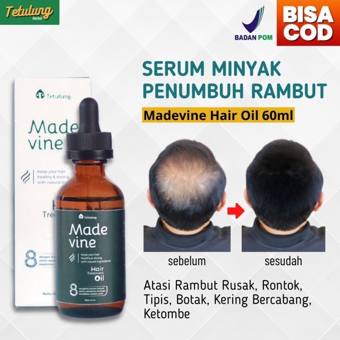 MADEVINE HAIR OIL - SERUM PENUMBUH RAMBUT BOTAK ALAMI [BPOM]