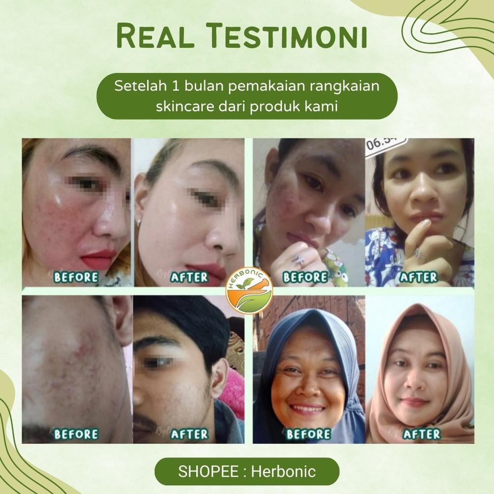 CR - REGLOW Skincare Original BPOM & HALAL Glowing Skin Treatment Paket Wajah Glowing Perawatan Keca