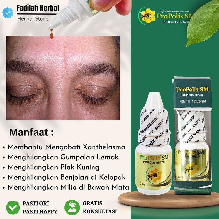 Obat Pembersih Xanthelasma Herbal Propolis SM Brazil