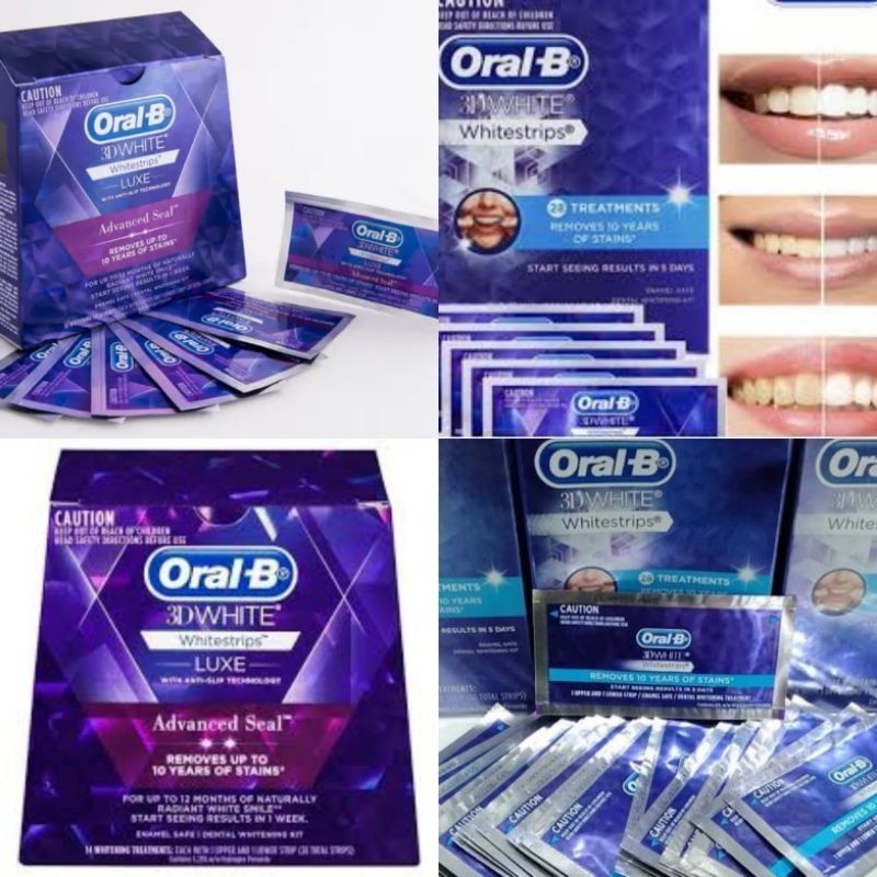 Oral B whitestrip, Whitening strip 3D, pemutih Gigi whitestrips Luxe oral B