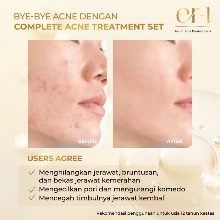 Er-1 By Dr. Erna Complete Acne Treatment Set 5 Pcs - Skincare Jerawat