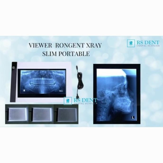 Viewer Rongent Xray Slim Portable