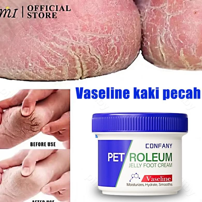 Obat Kaki Pecah Kaki Kering Dan Pecah Cream Kaki Pecah Dan Kering Penghalus Tumit Kaki Pecah Foot Cr