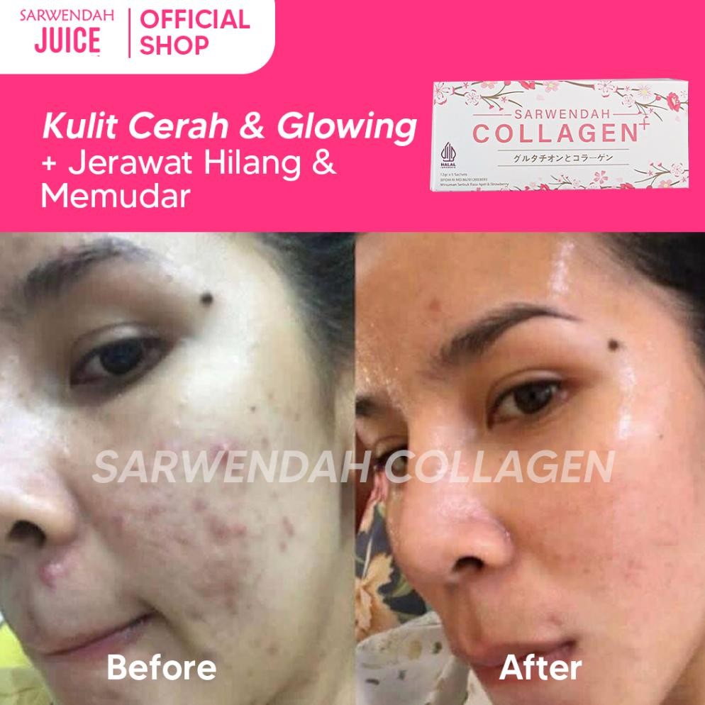 Sarwendah Juice (Isi 2) Sarwendah Collagen 5 Sachet & Call Me Glow 50gr - 2 Pcs
