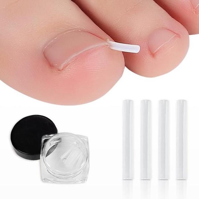 10Pc Bantalan Silikon Koreksi Perawatan Kuku Ingrown Nail Isolation Pad Cantengan Treatmen Kuku