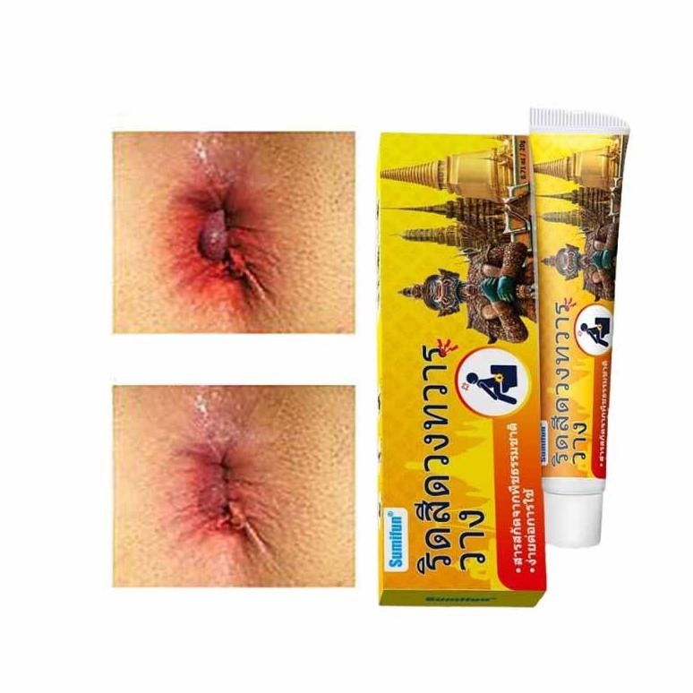 CODObat Wasir Salep Ambeien Paling Ampuh Original Salep Wasir Thailand Salep Krim Yang Ampuh Mengata
