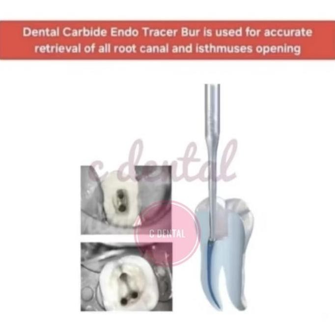 TERMURAH - Dental Carbide Endo Tracer Bur Long Slim Shank Opening Access Orifice Isthmus Finder Hidd