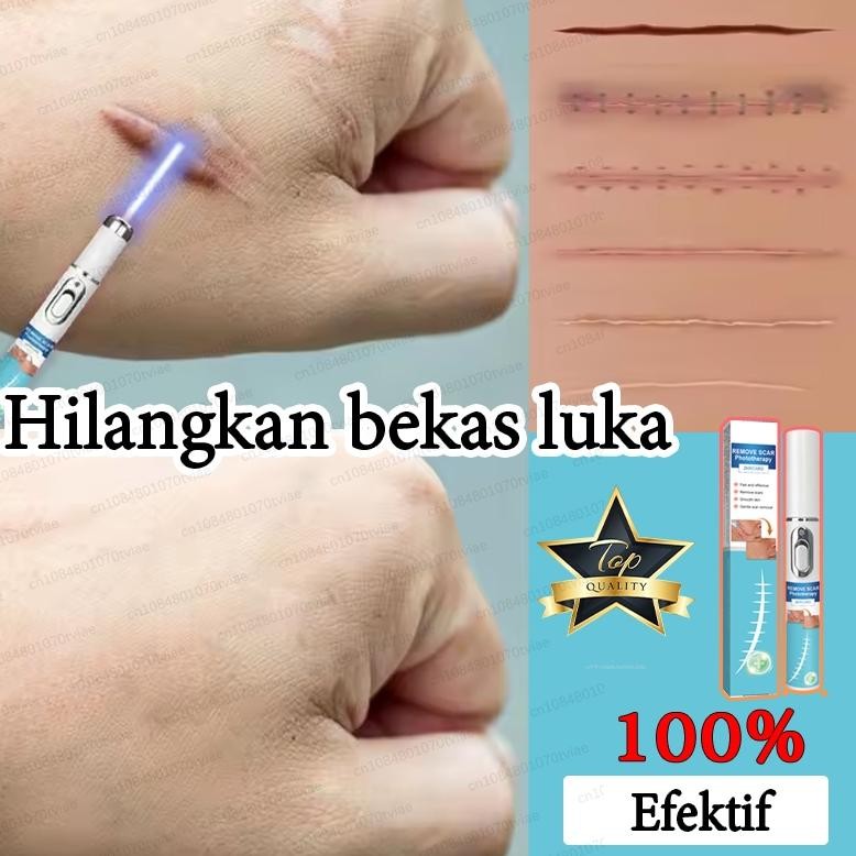 Pena Penghilang Bekas Luka Laser, Menghilangkan Bekas Luka, Memperbaiki Kulit, Cocok Untuk Luka Baka